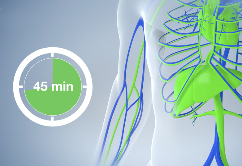 explanatory_video_infared_procedure